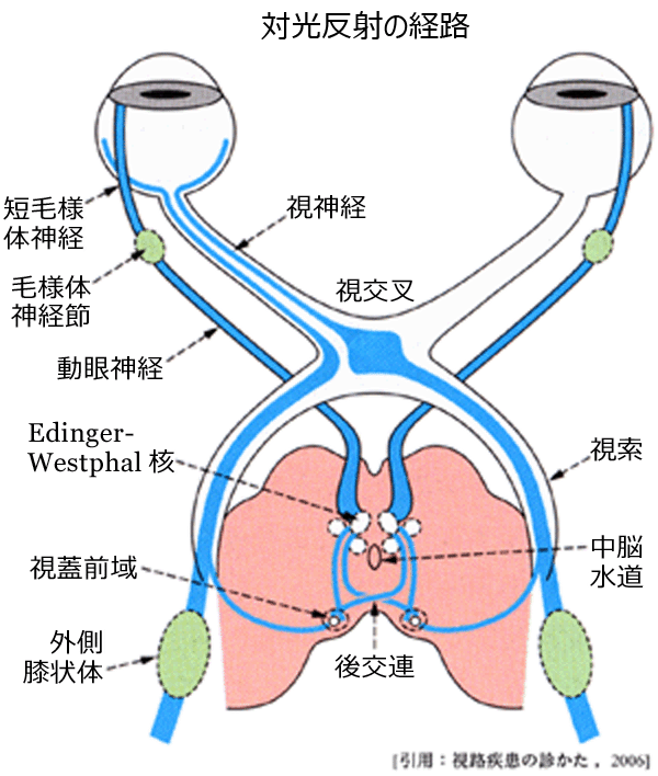 図