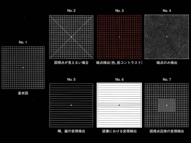 図 04 Amsler