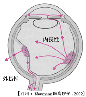 拡大方向