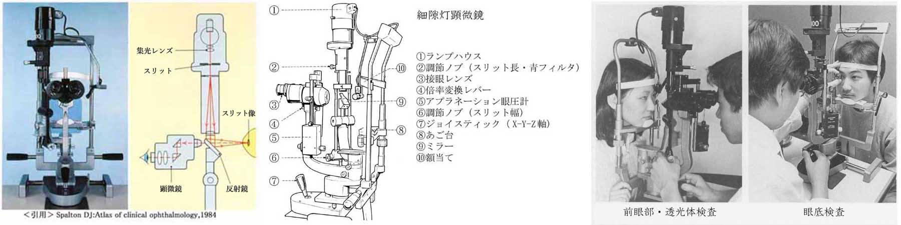 ②細隙灯顕微鏡