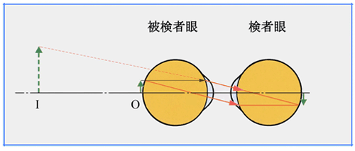 ①直像