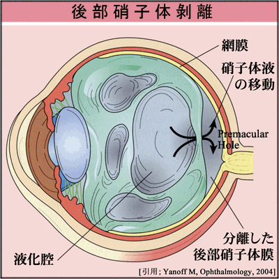 図 04