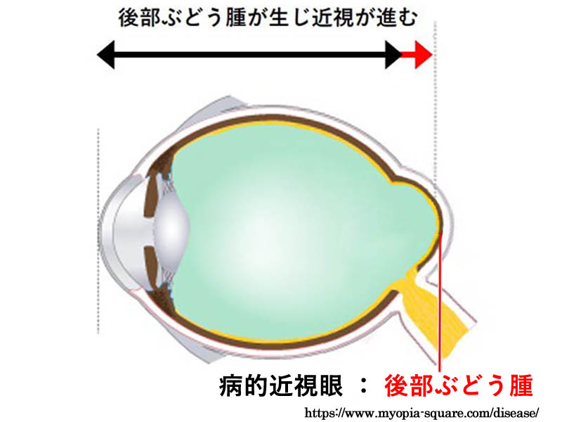 図 補 スタヒローマ